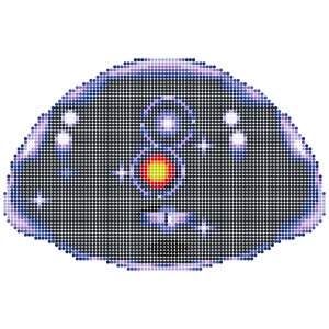 ヒューポスライム