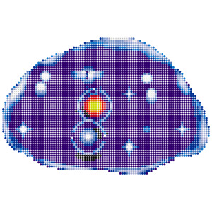 ヒューポスライム